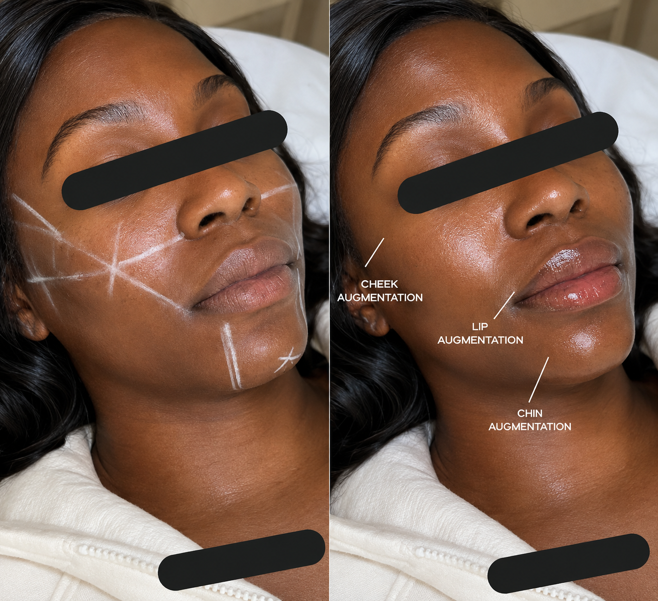 SV Luxe facial contour inspiration